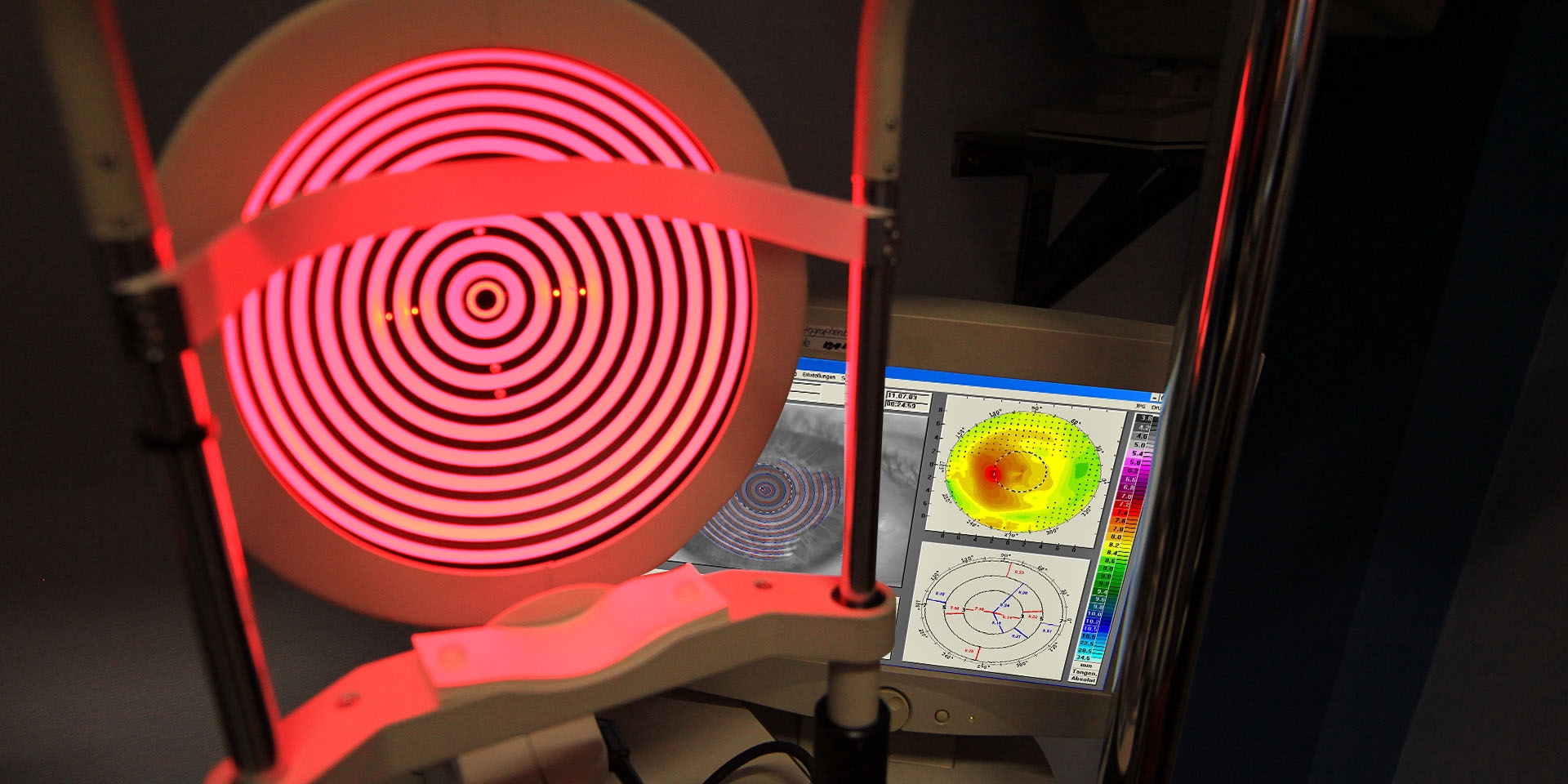 Keratograph zur individuellen Vermessung des Auges